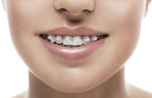 best orthodontist toronto on