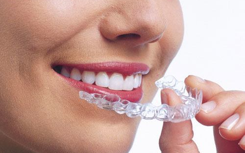 invisalign forest hill village on