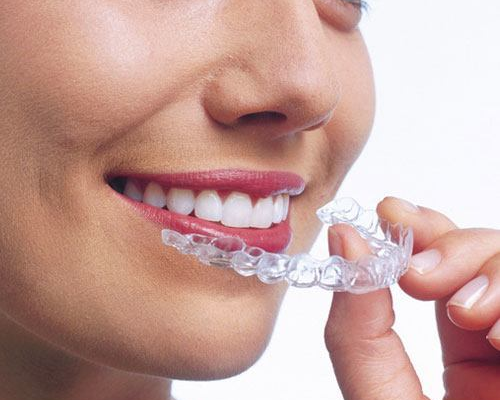 invisalign forest hill village on