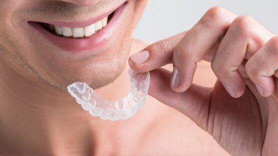 Affordable Clear Braces Near Me