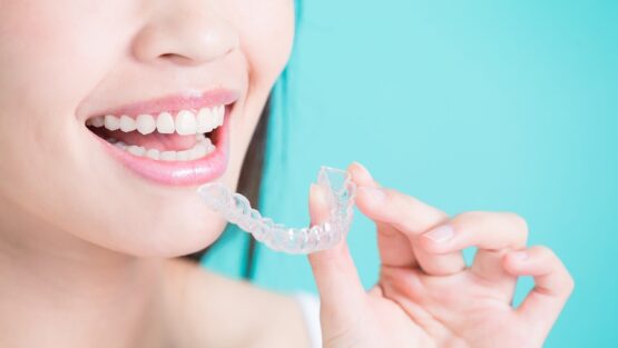 Clear Aligners Forest Hill ON