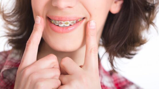 Affordable Orthodontic Treatment Toronto ON