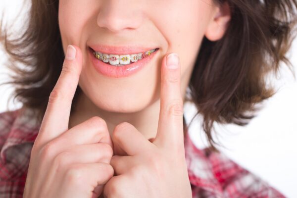 Affordable Orthodontic Treatment Toronto ON