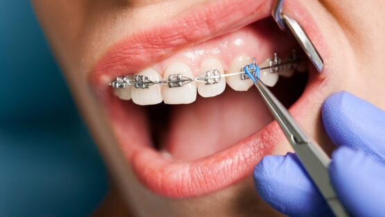 How much does an orthodontist cost?