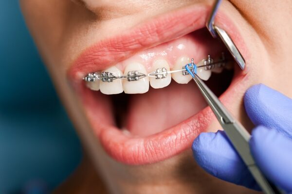 How much does an orthodontist cost?