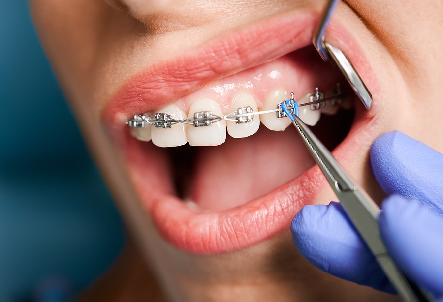 cost of orthodontist visit